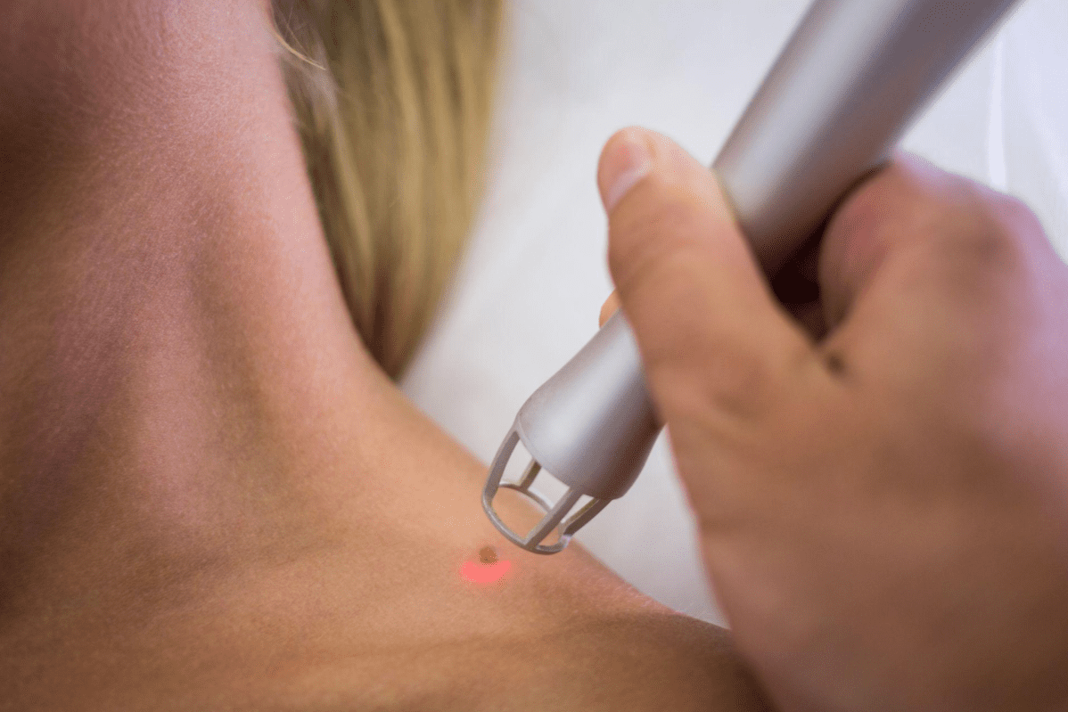 10 Klinik Dermatologi Terbaik di Pulau Pinang 2025 11 derma 1