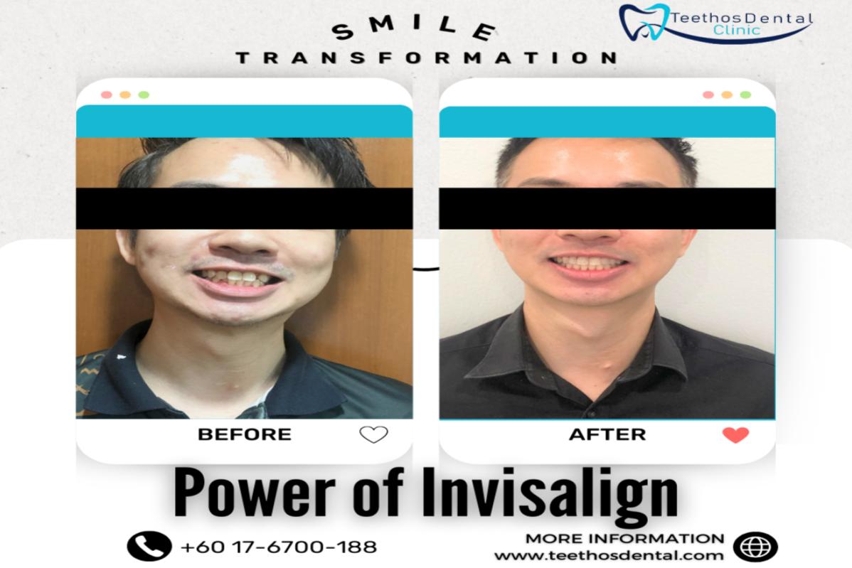 Top 10 Best Invisalign Clinics in Malaysia 2025 7 Teethos Dental Clinic 1