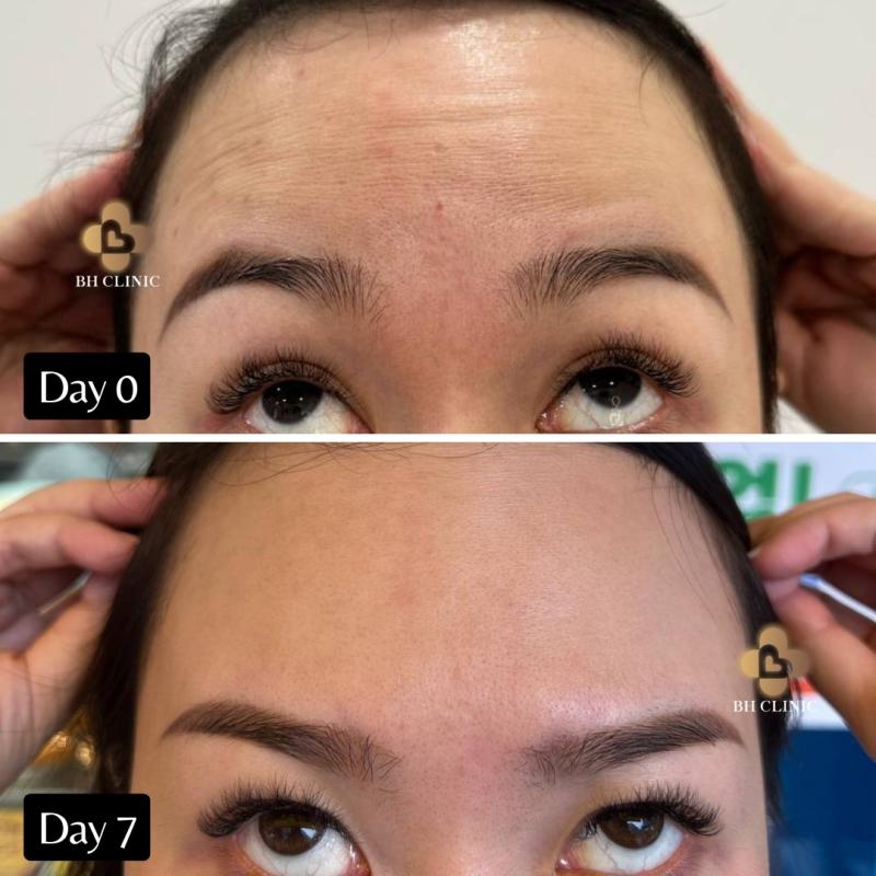 10 Klinik Estetik Terbaik di Sarawak 2025 17 BH Clinic 1