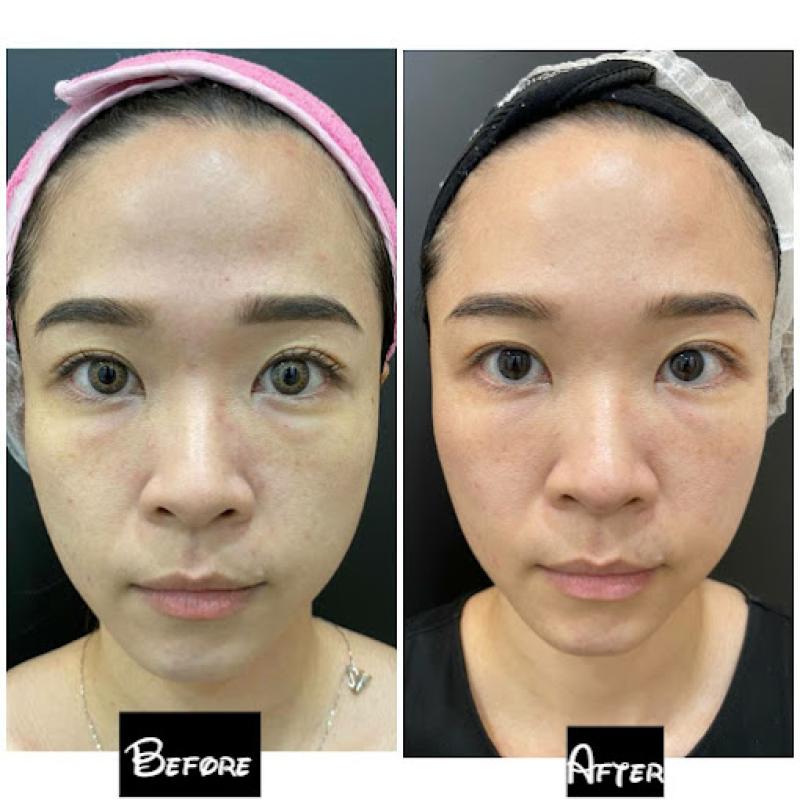 10 Klinik Estetik Terbaik di Ipoh 2025 9 Dr Elaine @ Beverly Clinic 1