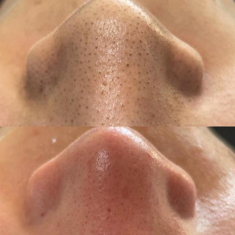 Top 10 Best Aesthetic Clinics in Sabah 2025 13 Elite Estetik Medispa Kota Kinabalu