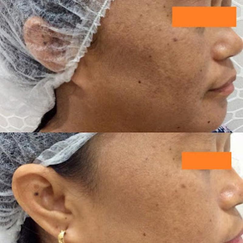 Top 10 Best Aesthetic Clinics in Sabah 2025 19 Klinik Mediglow Dr. Hema 1