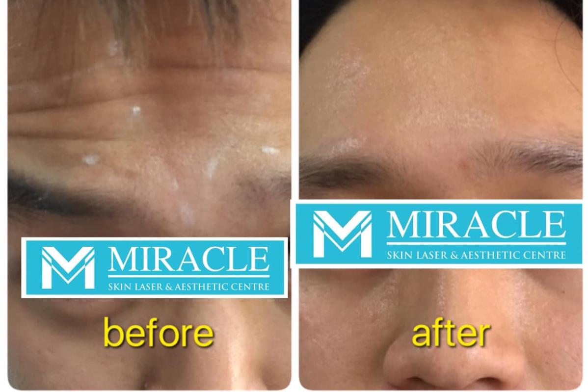 Top 10 Best Aesthetic Clinics in Sabah 2025 7 MI @ Miracle Skin Laser Aesthetics Centre 1
