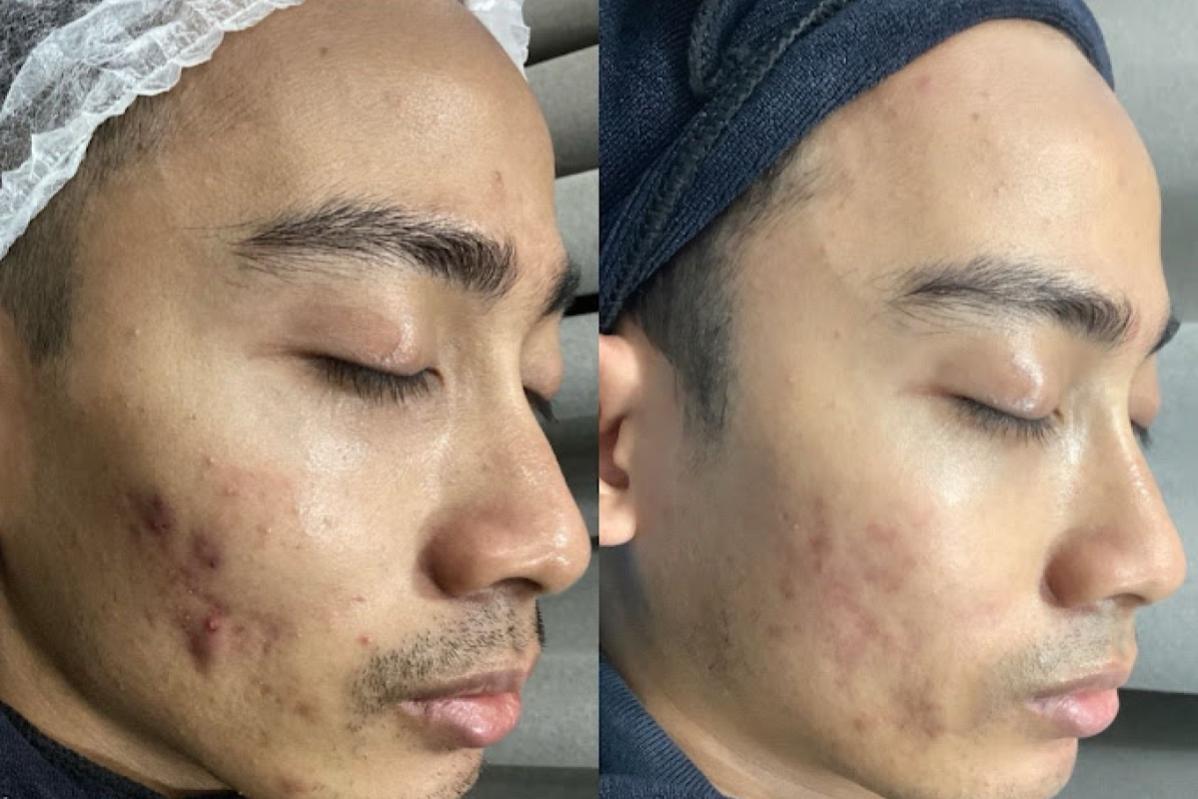 Top 10 Best Aesthetic Clinics in Melaka 2025 3 One Doc Melaka 1