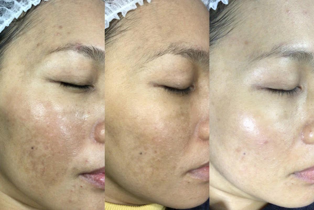 10 Klinik Estetik Terbaik di Ipoh 2025 4 One Doc X Hair Doc Ipoh 1