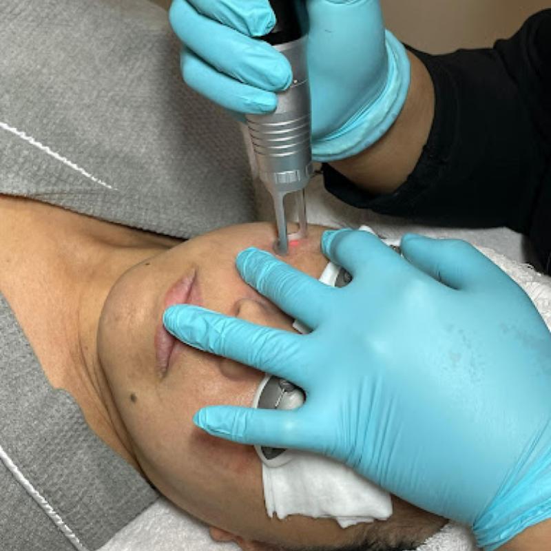 Top 10 Best Aesthetic Clinics in Sabah 2025 3 Piel Perfecta Laser Centre City Mall 1