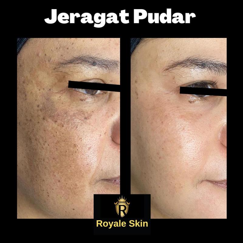 Top 10 Best Aesthetic Clinics in Melaka 2025 13 Royale Skin Medispa 1