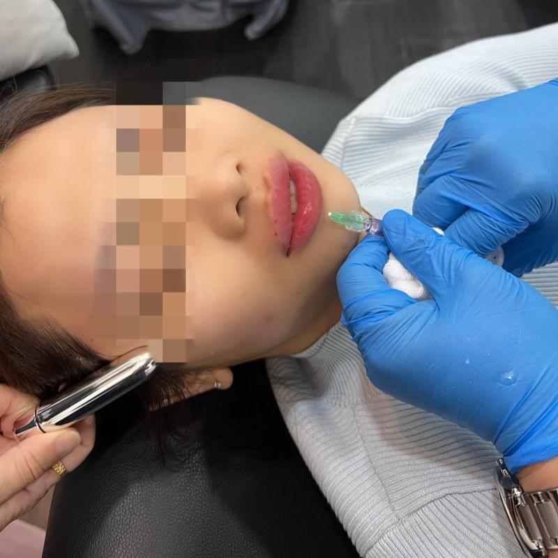 Top 10 Best Aesthetic Clinics in Melaka 2025 17 Yaps Clinic 1