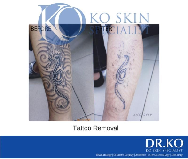 Top 10 Best Tattoo Removal Clinics in Penang 2025 15 Klinik Dr Ko Nibong Tebal 1 e1719901481918