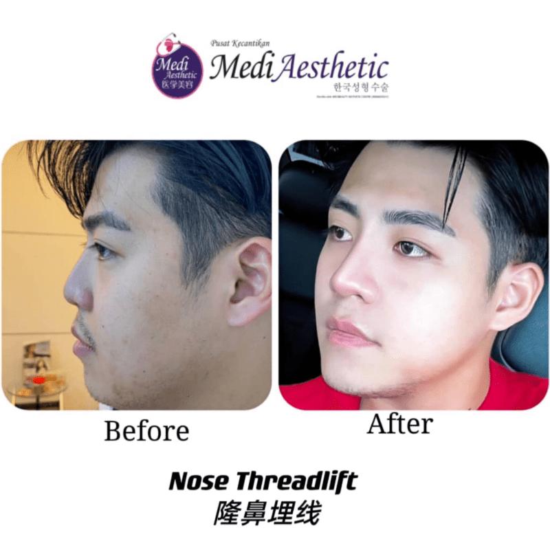 Top 17 Best Aesthetic Clinics in Johor Bahru 2025 23 Medi Aesthetic Johor specialises in pigmentation treatments