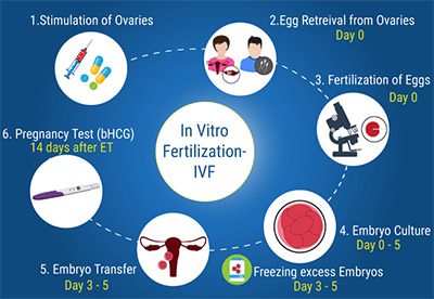 Top 7 Best Fertility Clinics in Melaka 2025 1 Processes of IVF 1 1
