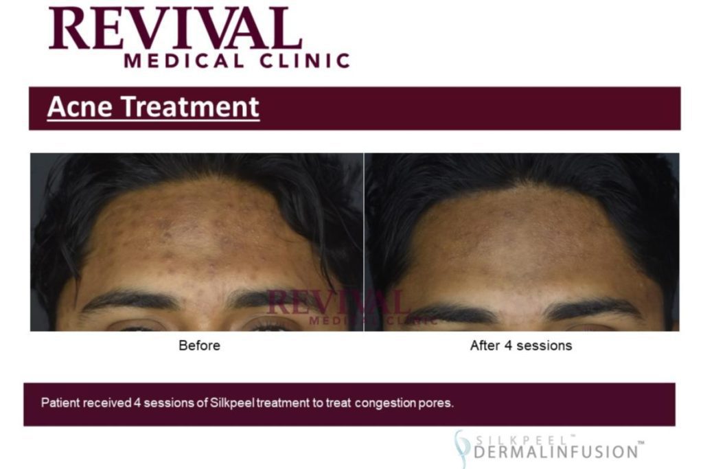 Top 17 Best Aesthetic Clinics in Johor Bahru 2025 9 Revival Medical Clinic focuses on skin analysis