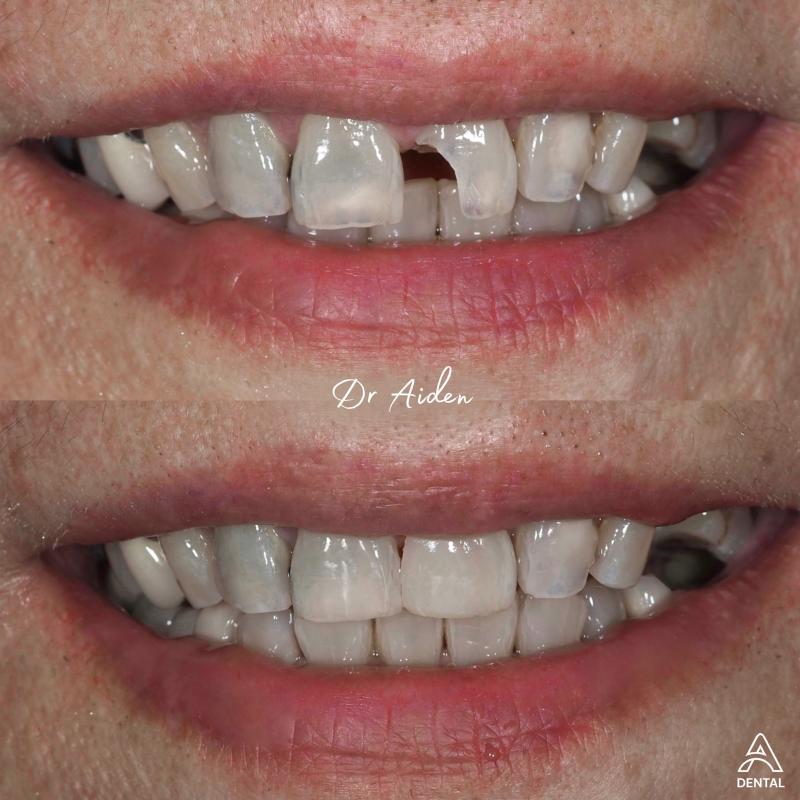 10 Pergigian Kosmetik Terbaik di Malaysia 2025 13 A Dental Clinic 1 1