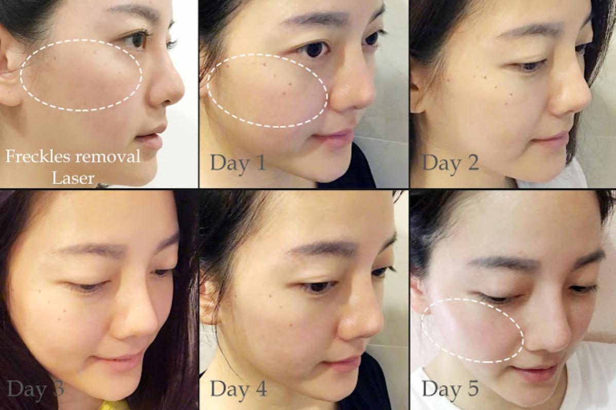 Top 10 Best Places for Stem Cell Treatments in Malaysia 2025 17 Beau Hans Clinic 1