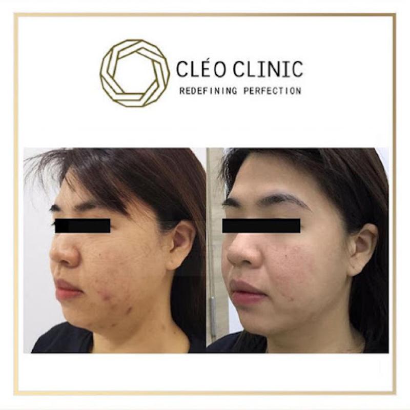 Top 10 Best Places for Stem Cell Treatments in Malaysia 2025 13 CLEO Clinic Sri Hartamas 1