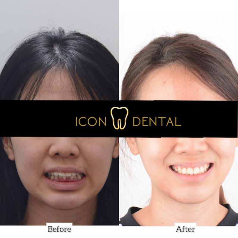 Top 10 Best Dental Clinics in Sri Petaling 2025 9 Icon Dental 1 1