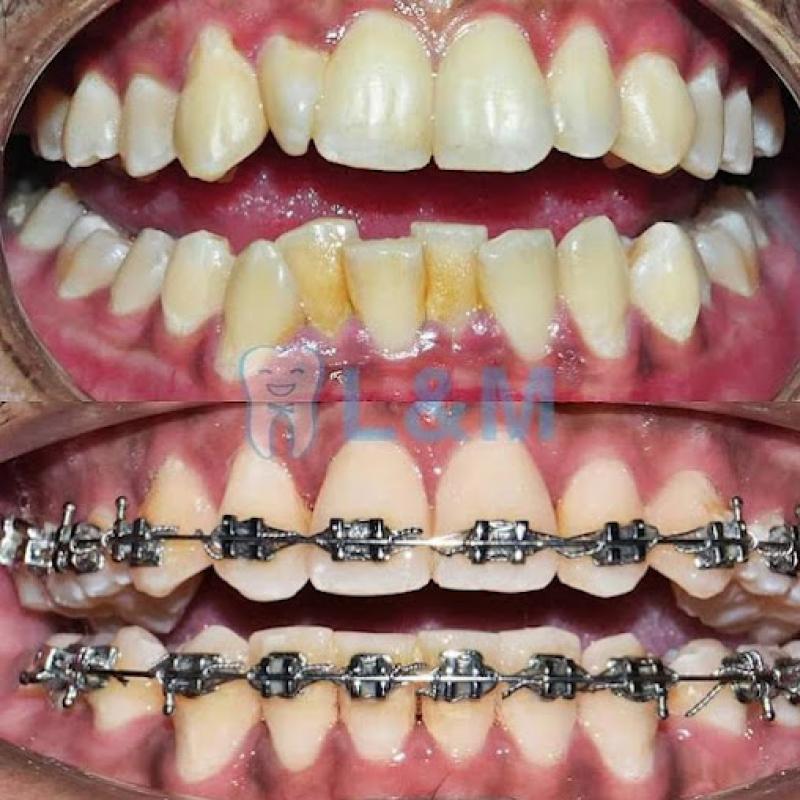 Top 10 Best Cosmetic Dentistry Clinics in KL & Selangor 2025 3 LM Dental Clinic 1