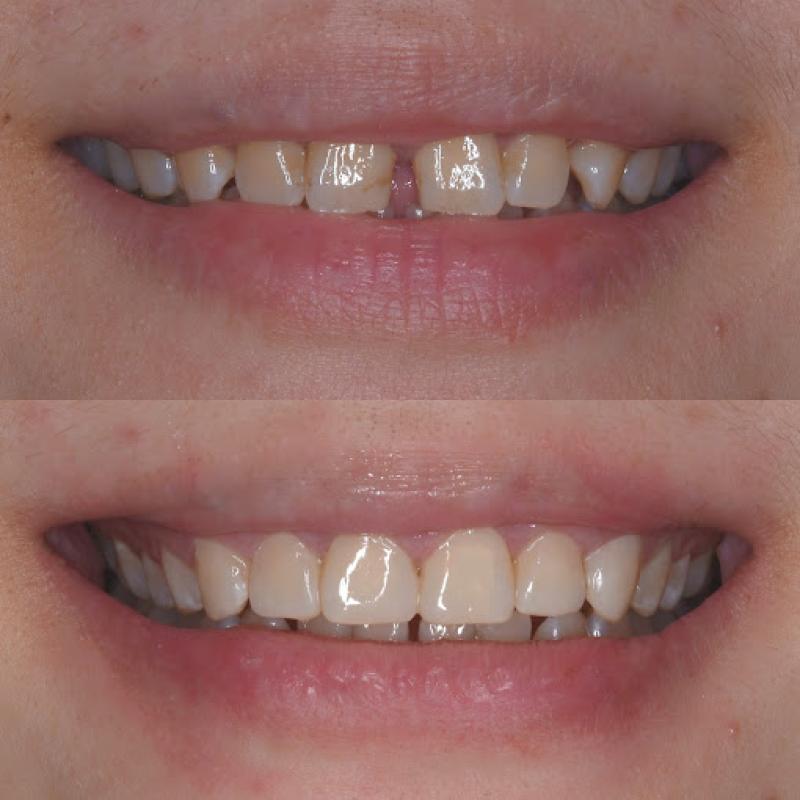 Top 10 Best Dental Clinics in Sri Petaling 2025 3 Lau Dental Clinic 1