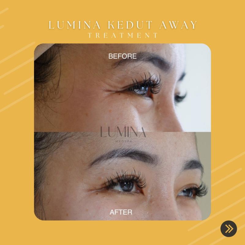 Top 10 Best Medispa in KL & Selangor 2025 13 Lumina Medspa Bukit Jalil 1 1