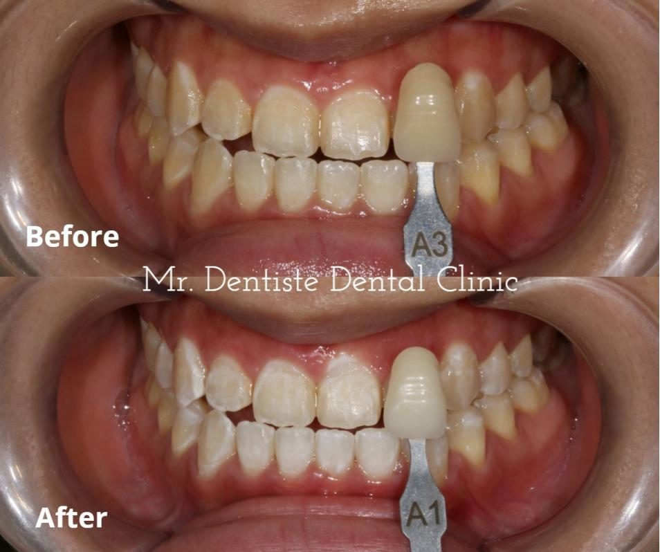 Top 10 Best Dental Clinics in Sri Petaling 2025 17 Mr. Dentiste Dental Clinic 1 e1724906783540
