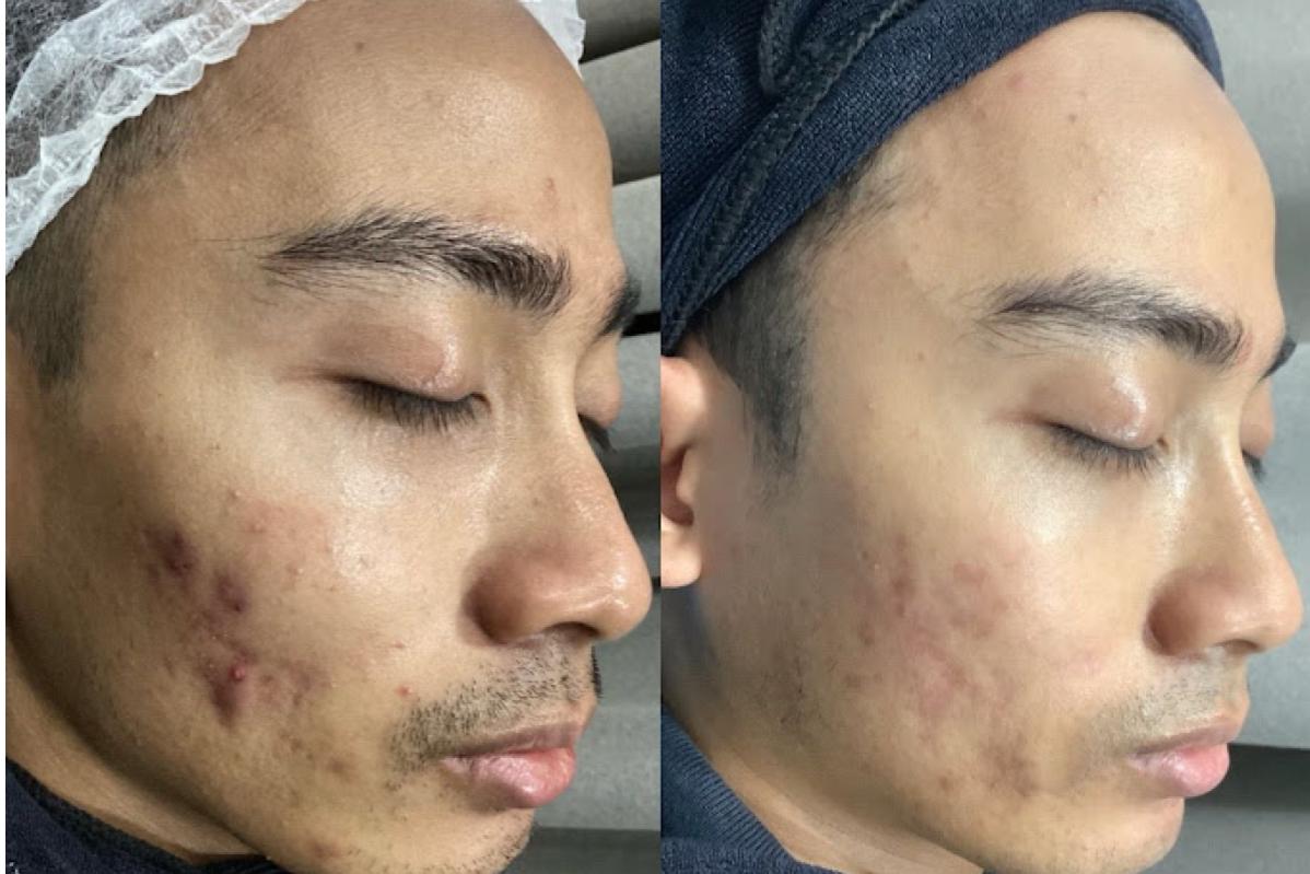 Top 10 Best Places for Stem Cell Treatments in Malaysia 2025 21 One Doc Melaka 1 1