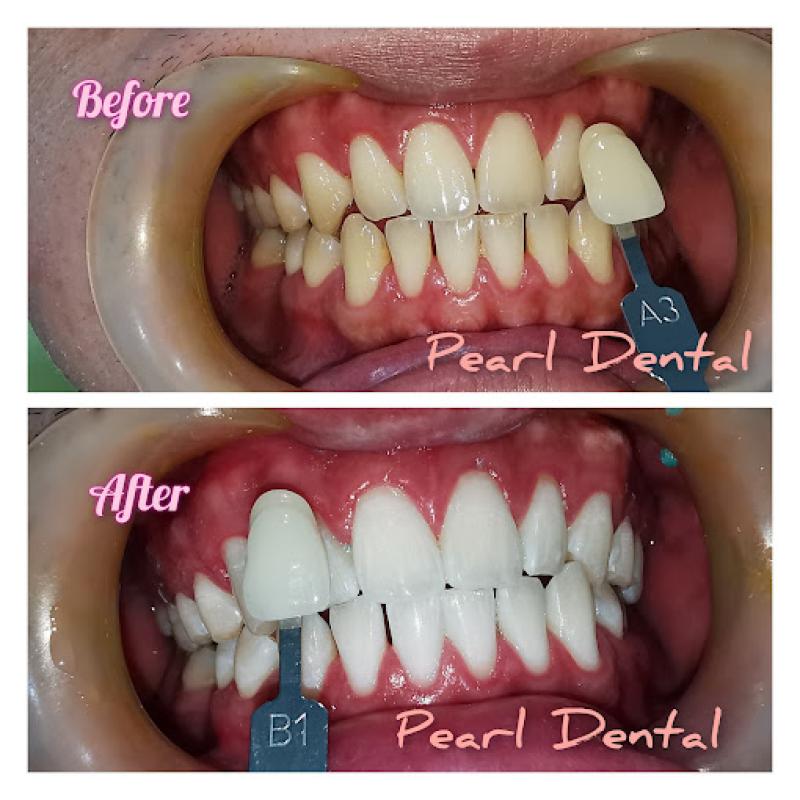 10 Pergigian Kosmetik Terbaik di Pulau Pinang 2025 9 Pearl Dental Clinic