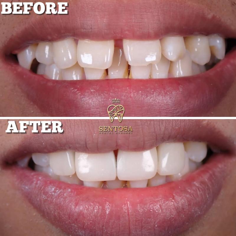 10 Klinik Pergigian Kosmetik Terbaik di Johor 2025 17 Sentosa Dental Clinic 1