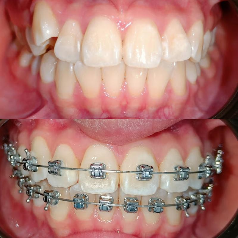 Top 10 Best Cosmetic Dentistry Clinics in KL & Selangor 2025 19 Smileage Dental Clinic 1