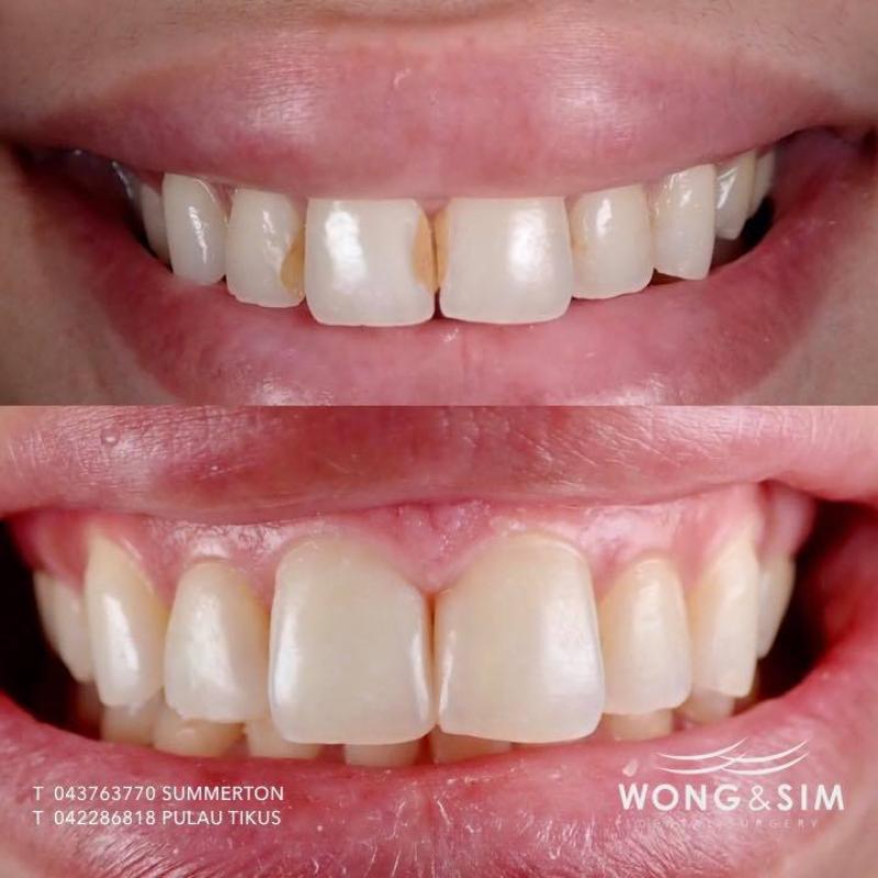 10 Pergigian Kosmetik Terbaik di Pulau Pinang 2025 19 Wong Sim Dental Surgery focuses on dentist services and smile makeovers