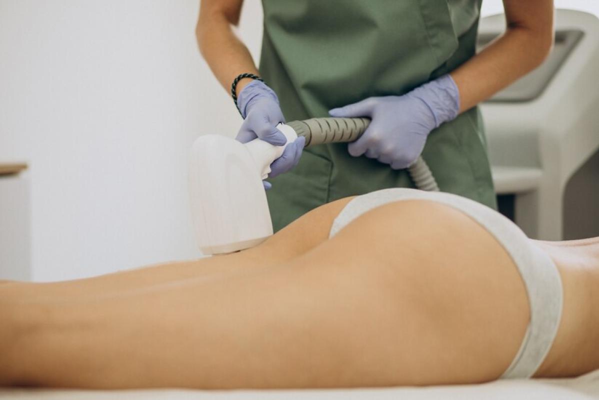 Top 10 Best Cellulite Treatment Clinics in Johor 2025 5 MyClinic 3
