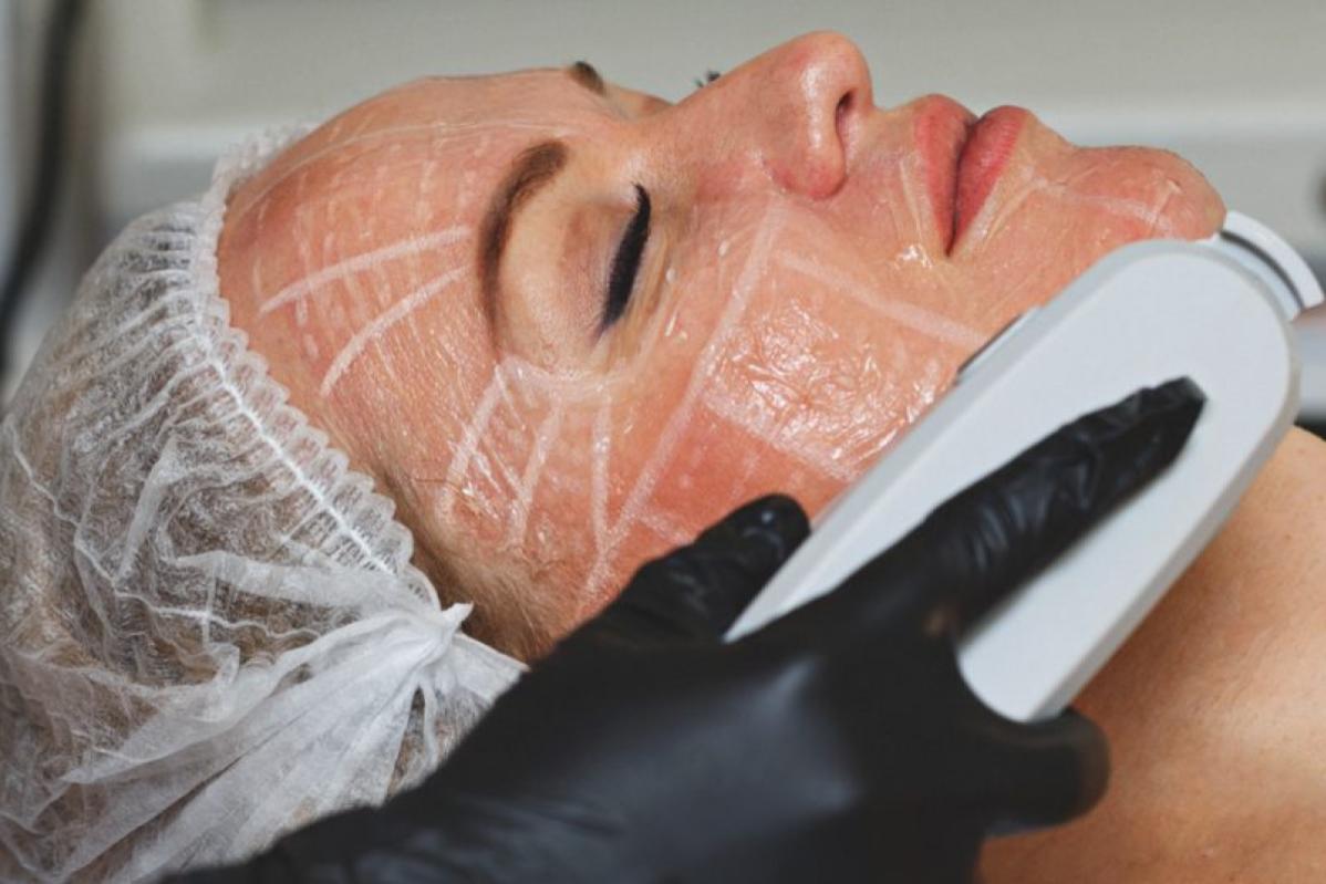Top 10 Best HIFU Treatment Clinics in KL & Selangor 2025 5 Skin Renew 1