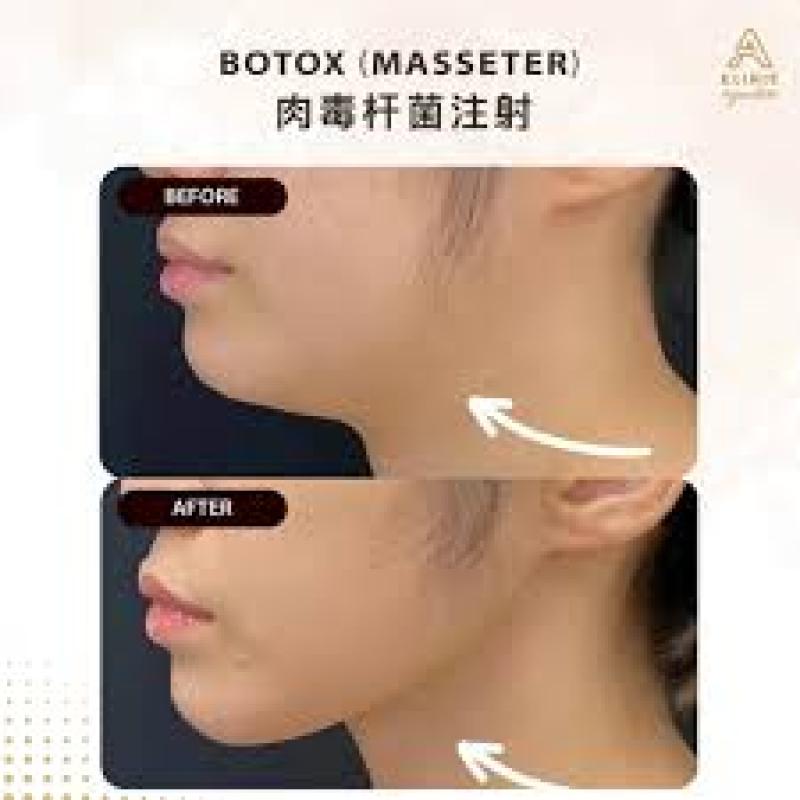 10 Klinik Botox Terbaik di Penang 2025 3 A Klinik Signature 5