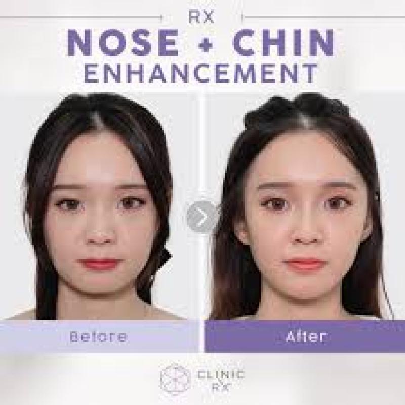 Top 10 Best Botox Clinics in Johor 2025 5 Clinic RX 5