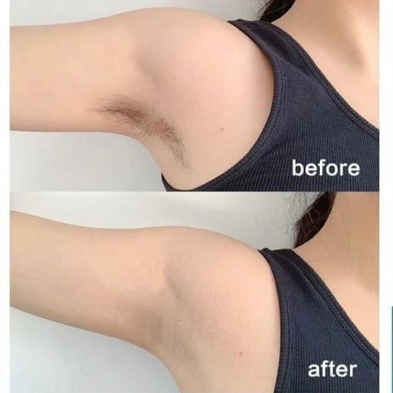 Top 10 Best Laser Hair Removal Clinics in Johor 2025 9 Estee Medic 1