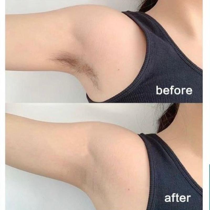 Top 10 Best Laser Hair Removal Clinics in Malaysia 2025 17 Estee Medic Kulai 1