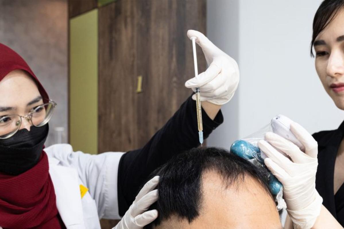 Top 10 Best Hair Loss Treatment Clinics in Penang 2025 13 Feathair 1