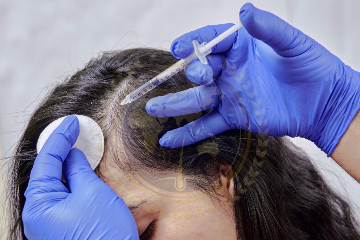 Top 10 Best Hair Loss Treatment Clinics in Malaysia 2025 7 Glojas Clinic 1