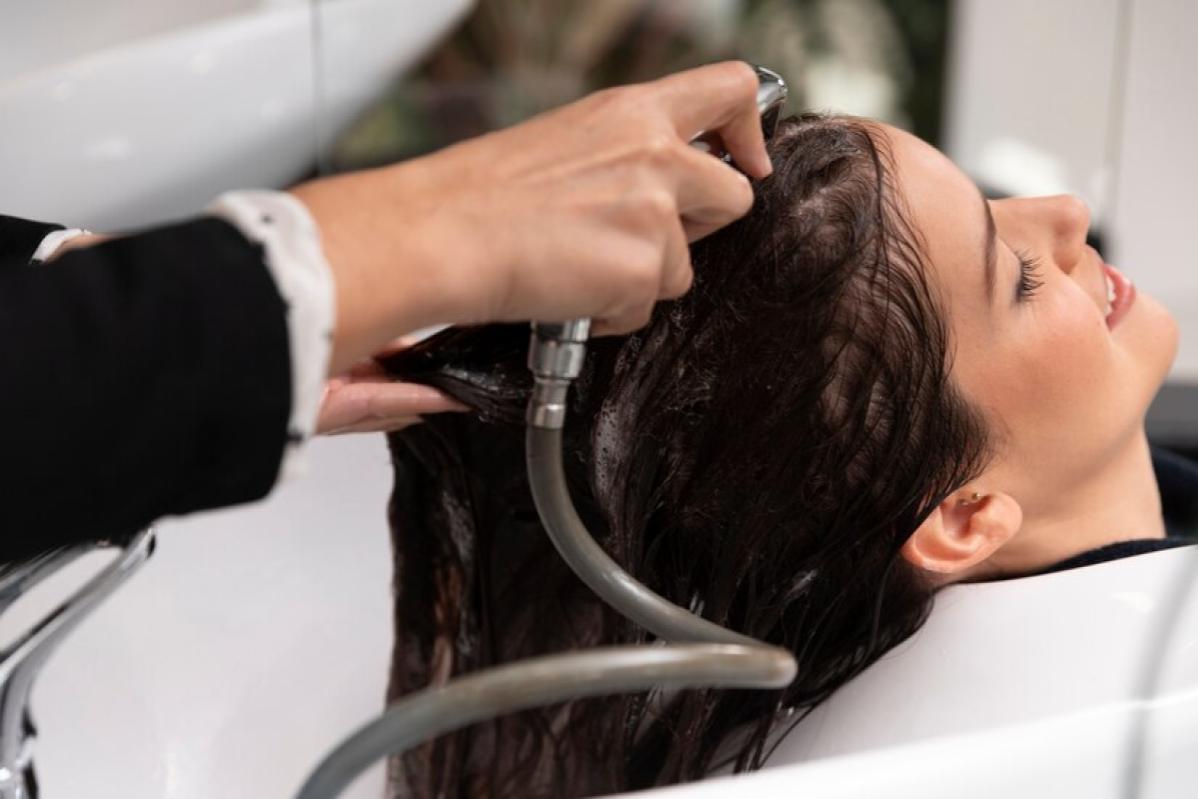 Top 10 Best Hair Loss Treatment Clinics in Penang 2025 9 Midyson Hair Scalp Wellness 1 1