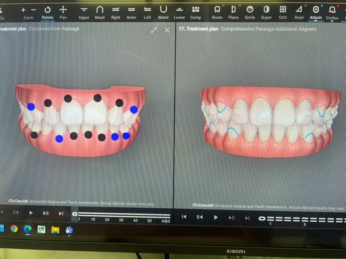 Top 12 Dental Implants in Malaysia 2026 6 Imperial Dental Specialist Centre Bangsar Kuala Lumpur